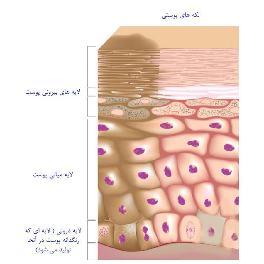 ساختار پوست