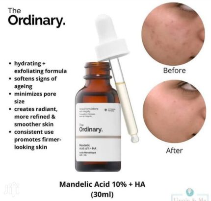 سرم ماندلیک اسید اوردینری ضد چروک و ضد لک Ordinary Mandelic Acid